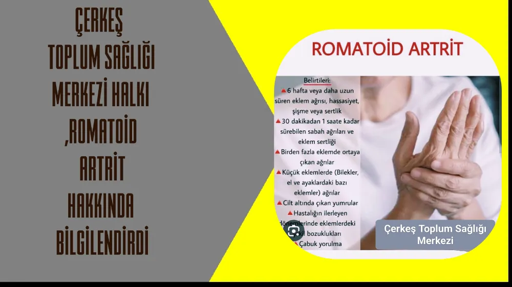 Çerkeş toplum sağlığı merkezi halkı ,Romatoid Artrit hakkında  bilgilendirme amaçli bir mesaj yayınladı