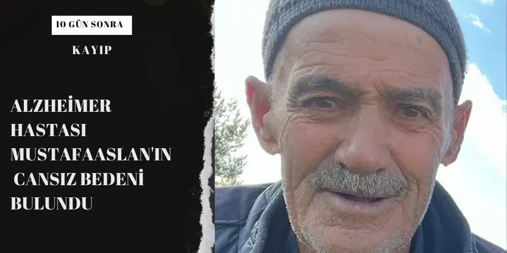 Alzheimer hastası  MustafaAslan